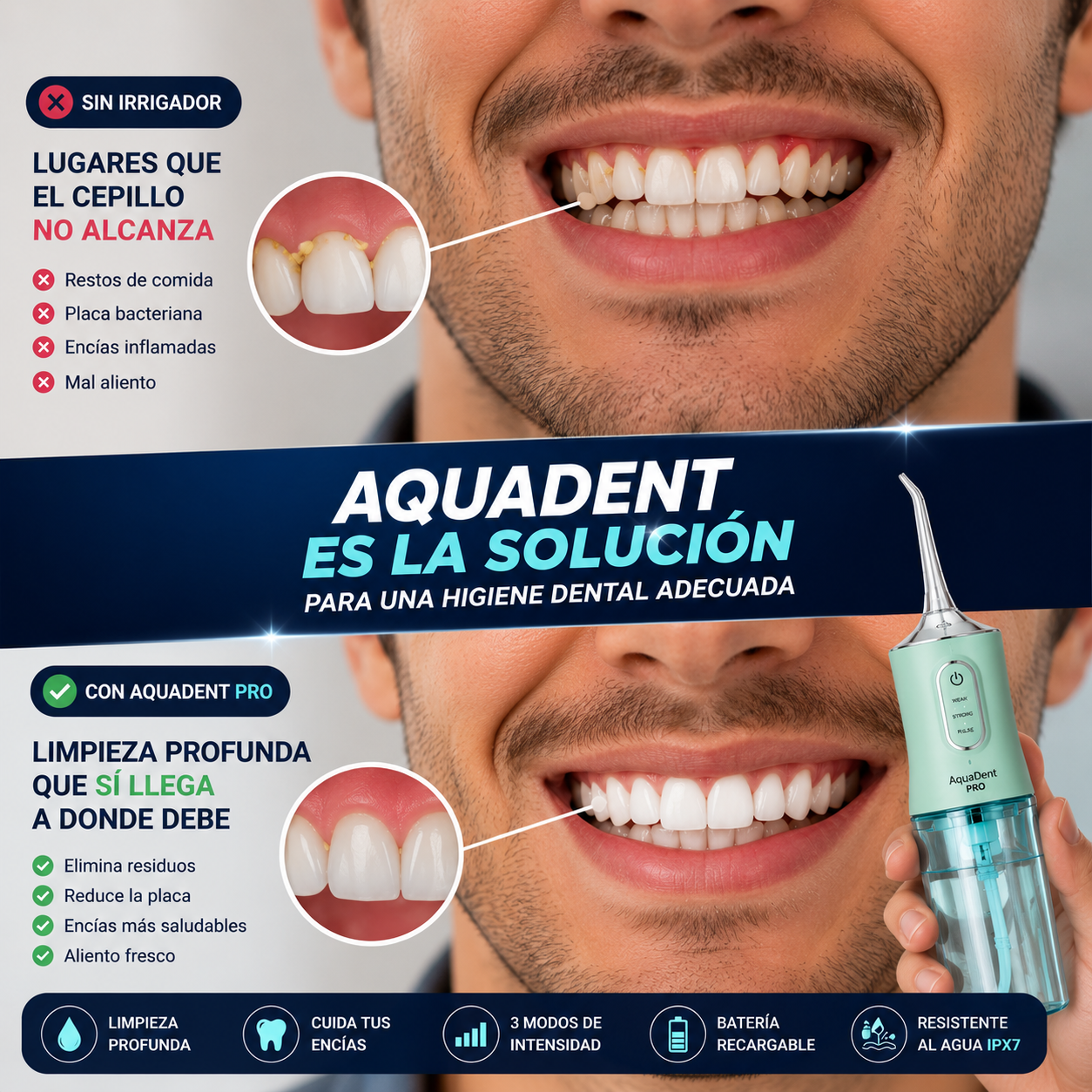AQUADENT PRO 🦷 LIMPIADOR DENTAL IRRIGADOR.